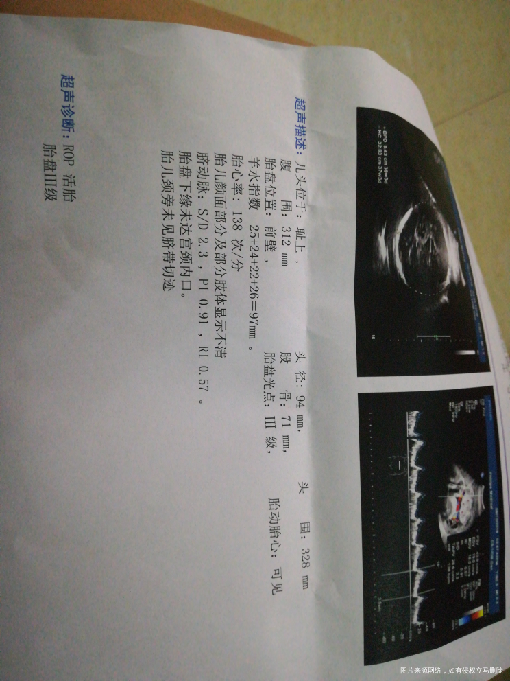 请医生帮我看一下宝宝有几斤了