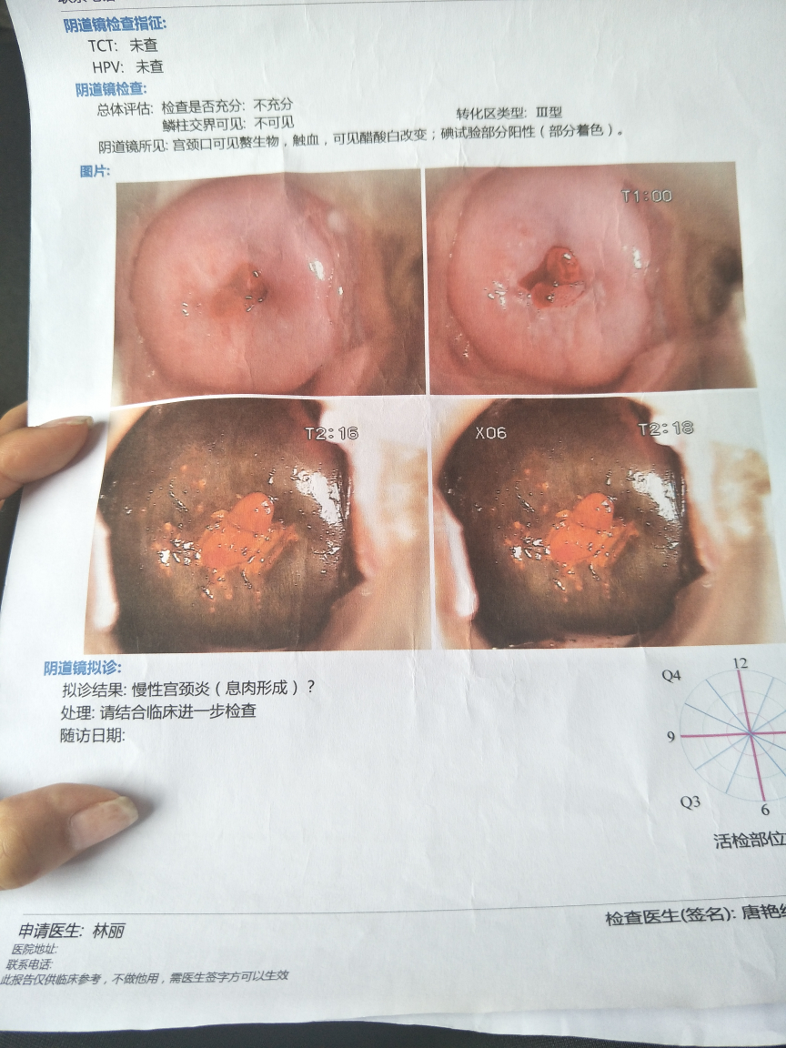 求助医生看下检查报告。