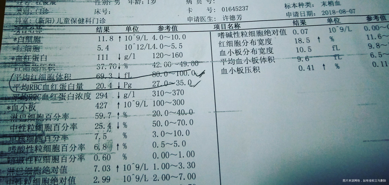 求助医生,是地中海贫血吗