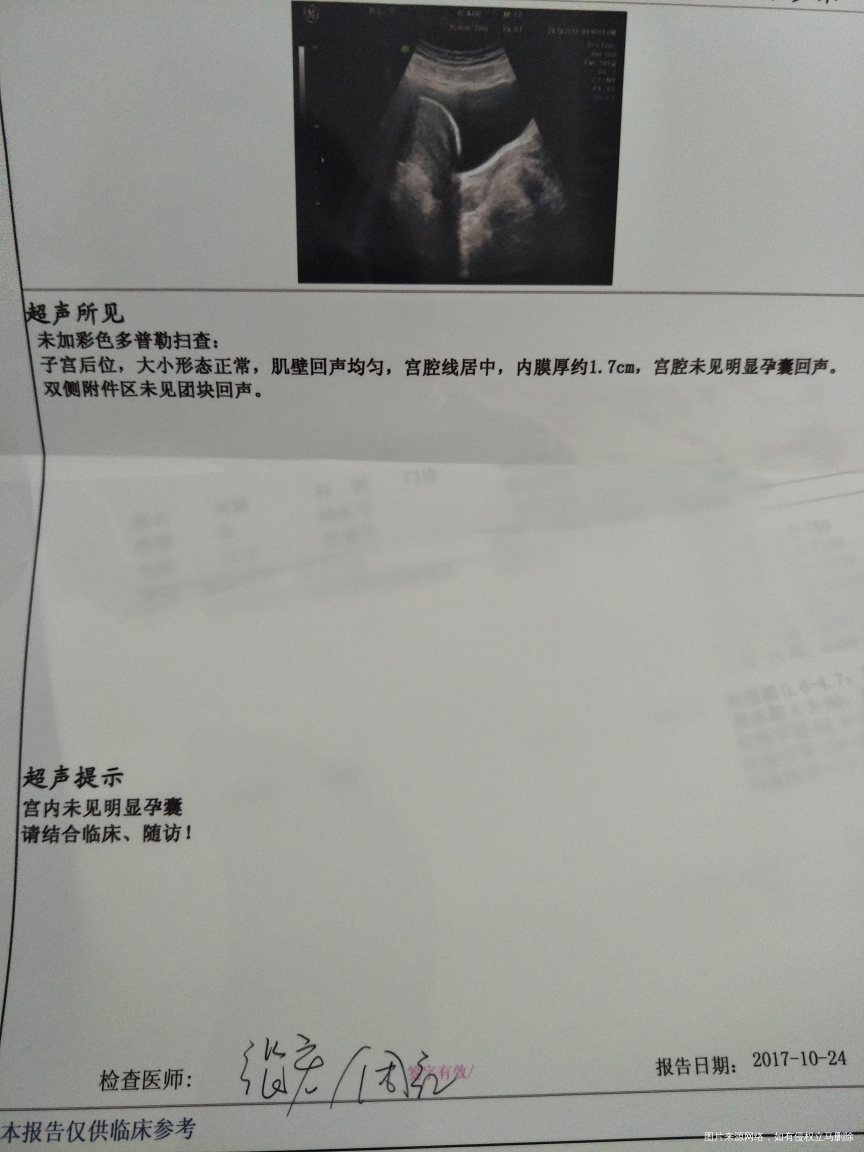 求医生帮忙看看,正常不?