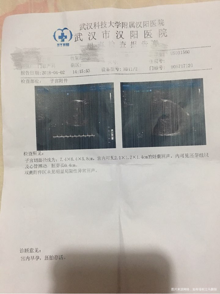 今天去医院做检查了。医生没说怀孕多少周