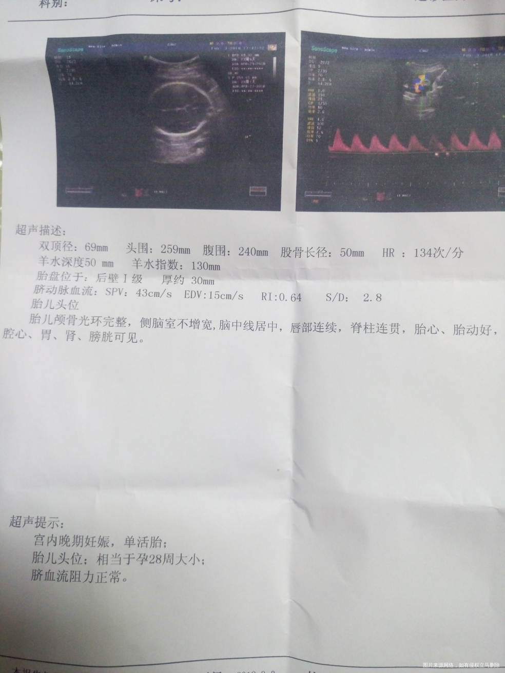 #新年宝贝计划#+愿宝宝平安健康的到来