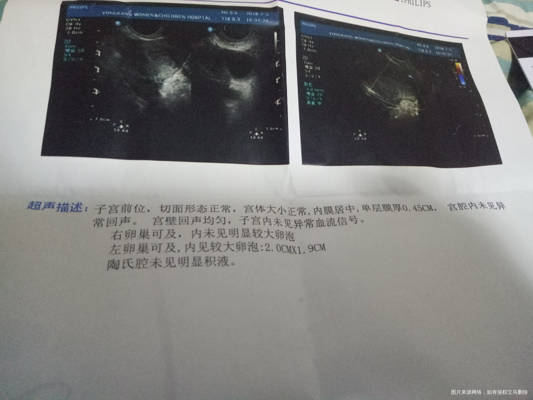 医生帮我看看,这是第14天测排卵的