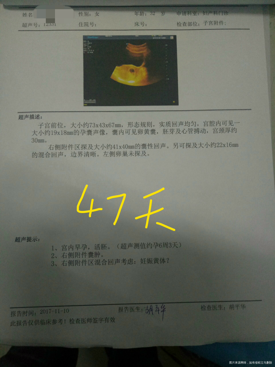 医生帮忙看看现在情况还好吗