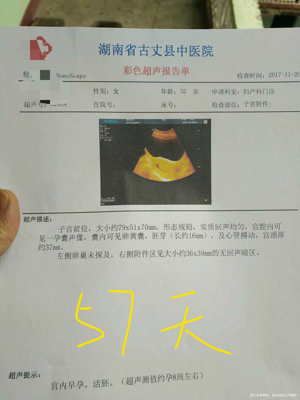 医生帮忙看看现在情况还好吗