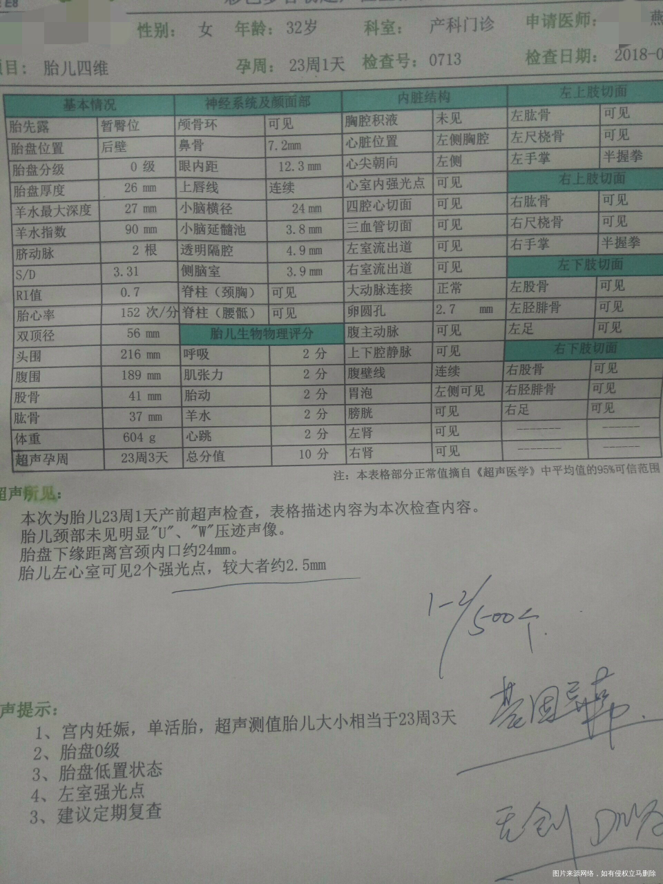 23周四维检查☞左室强光点!要不要紧呀!