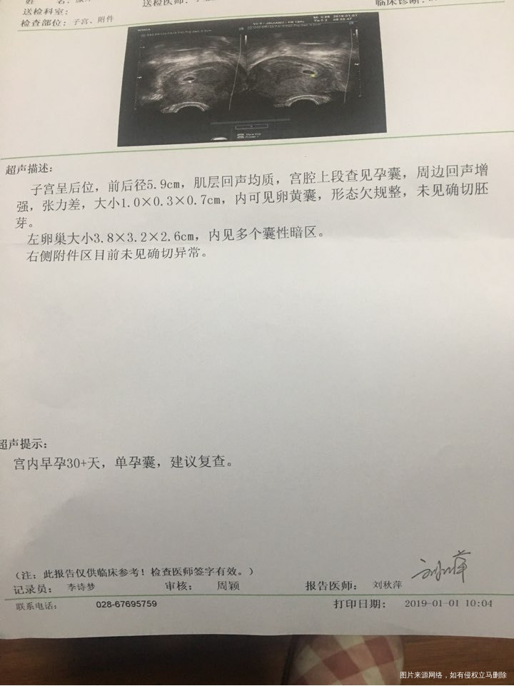 请问医生我的宝宝还能留下吗