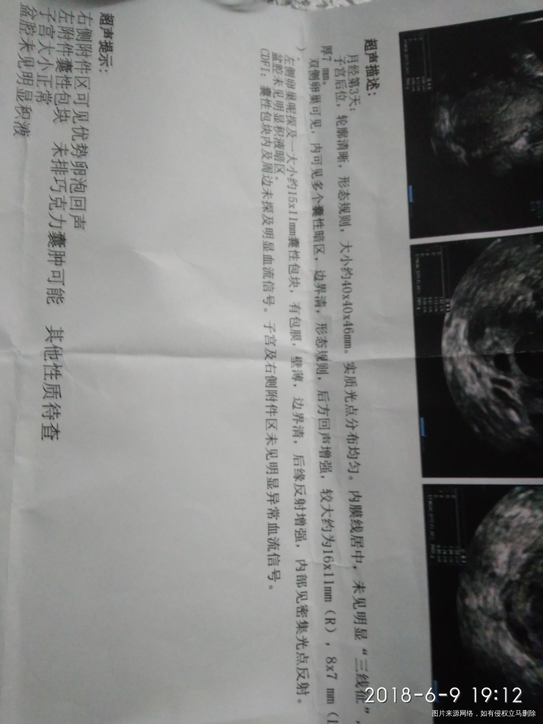 经期第三天做的B 超跟性激素