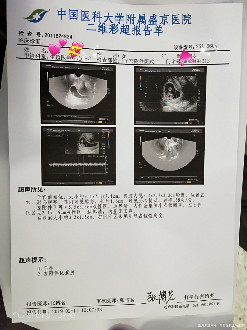 一超顺利通过,一个猪宝🤗