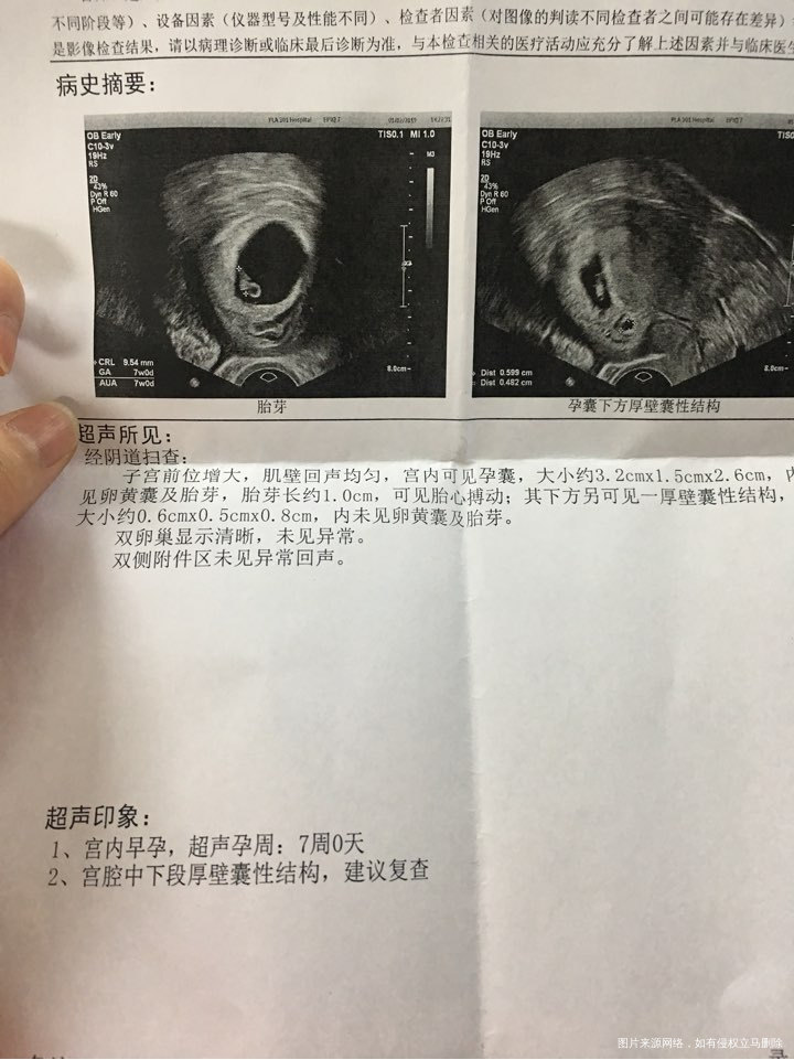 移植了两个 成功了一个 另一个怎么办