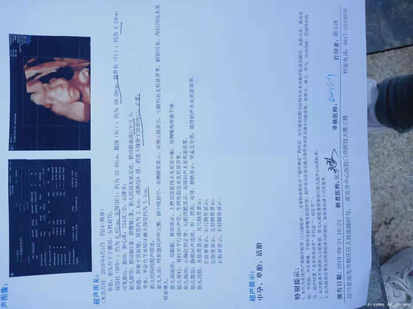 请医生帮我姐姐的宝宝看一哈心脏彩超的报告!