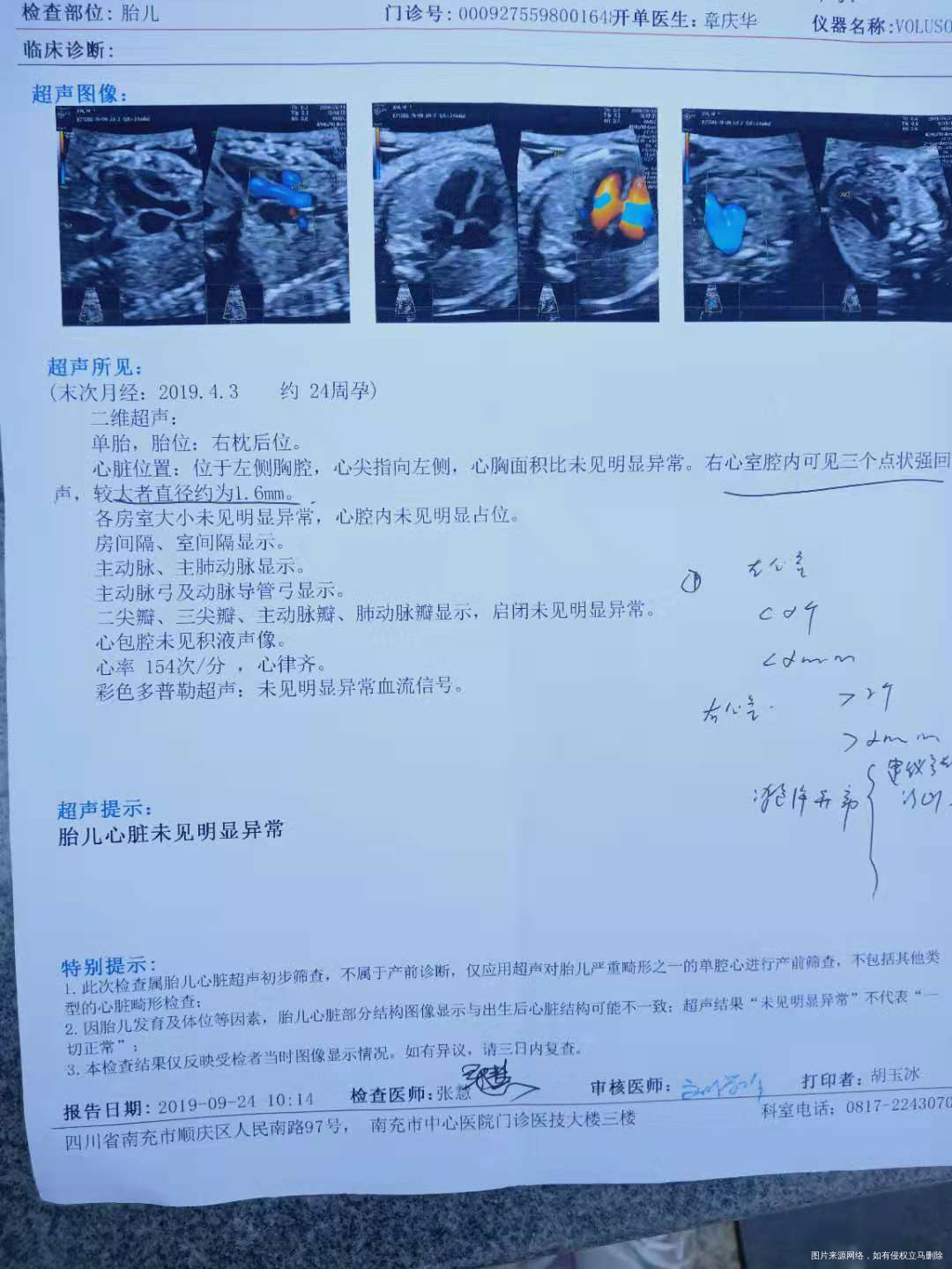 请医生帮我姐姐的宝宝看一哈心脏彩超的报告!