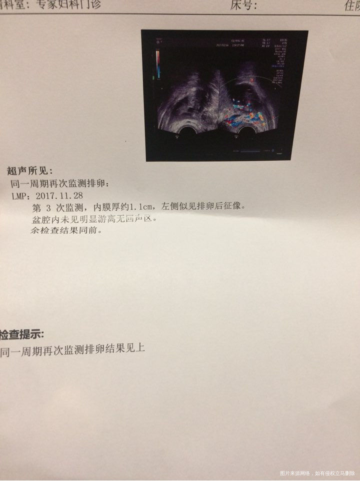 希望我这次备孕成功了
