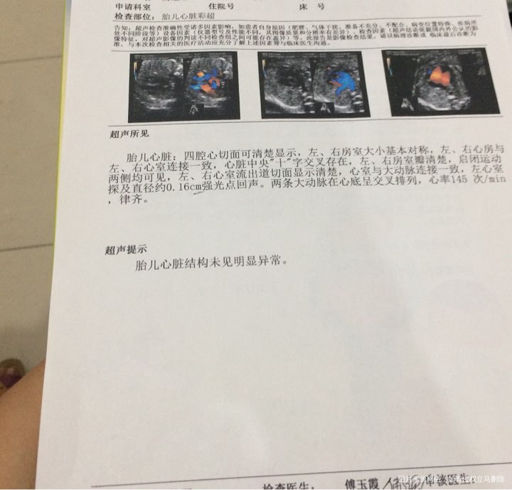 怀孕22周检查系统B超医生说我这个胎盘有点小