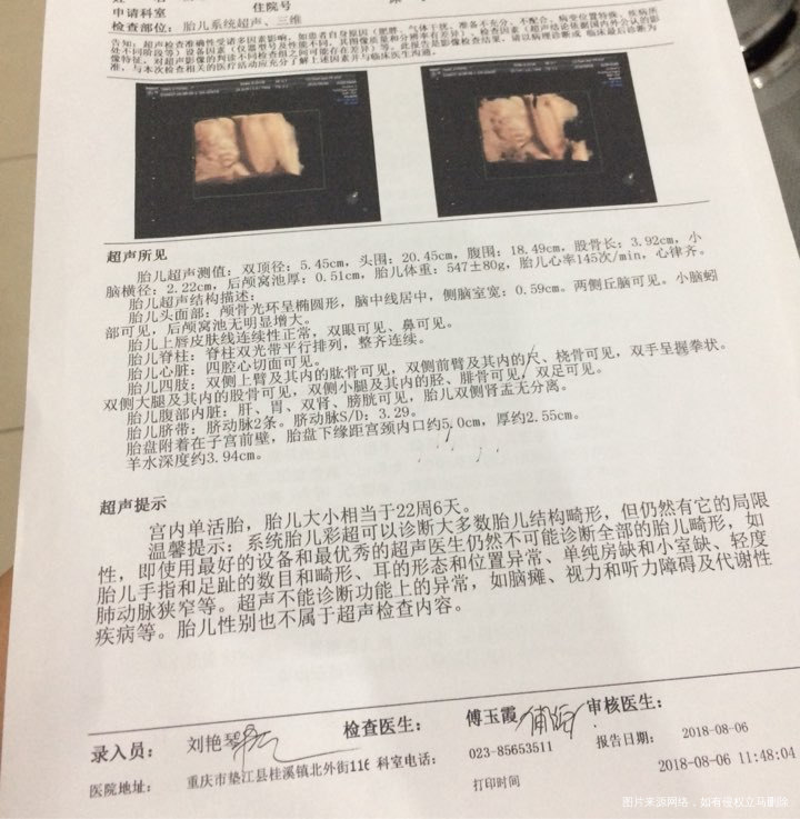 怀孕22周检查系统B超医生说我这个胎盘有点小