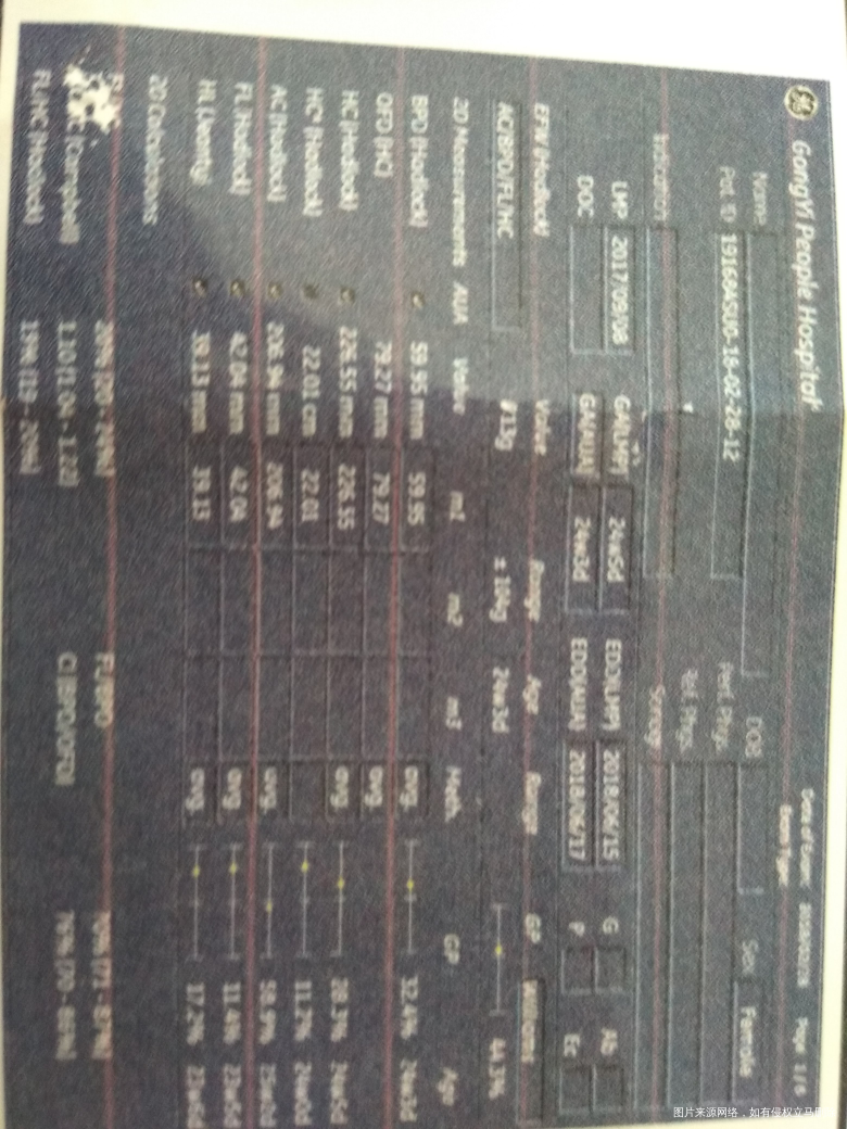 请在线医生看看这个是不是胎儿的性别