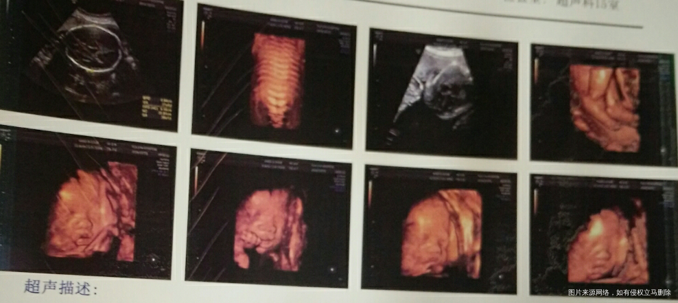 谢谢你的光临我的小怪物