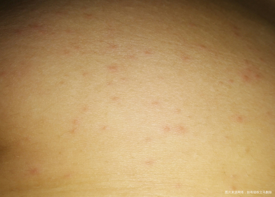 请问大家知道这是怎么回事吗?