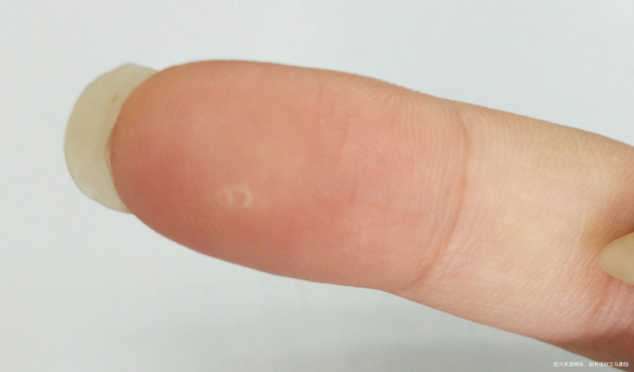 孕10周,手指掉皮,是缺乏维生素吗?