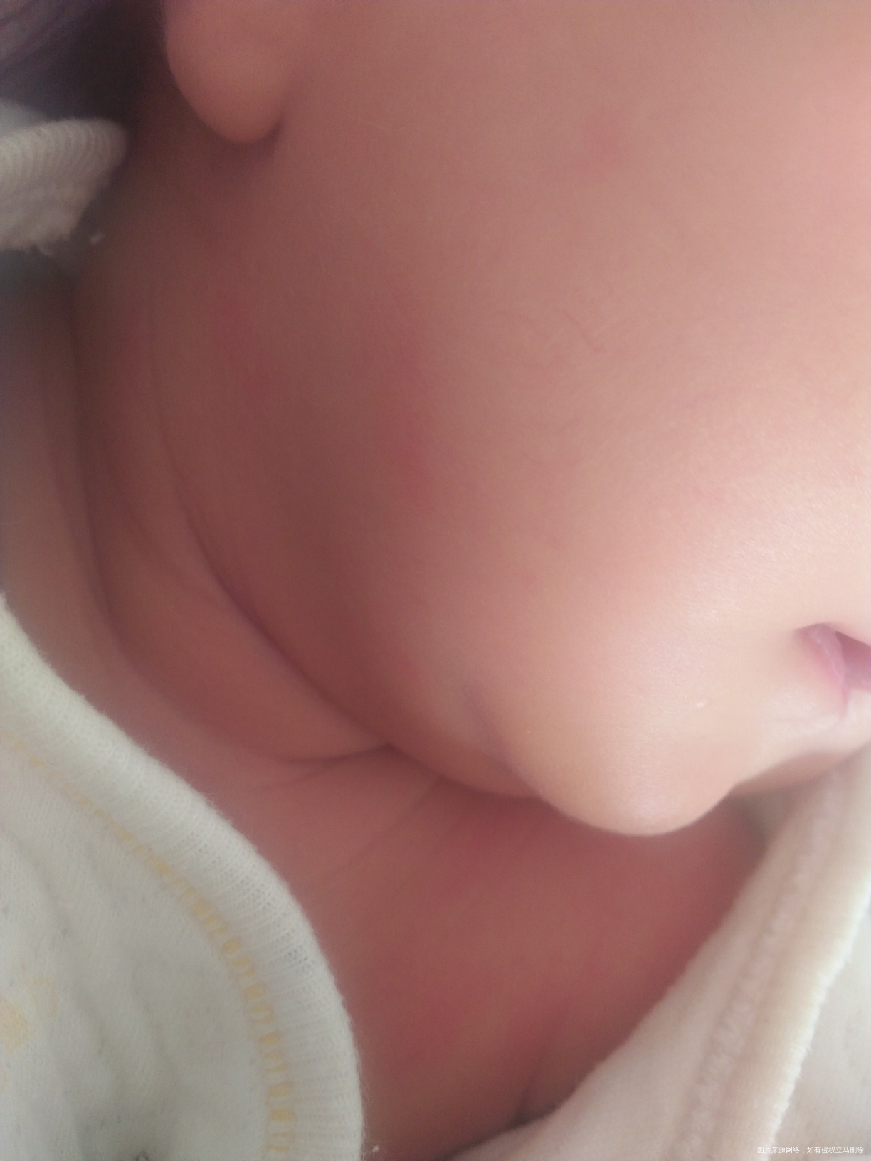 帮我看看宝宝脸颊 和肩膀都红红的是怎么了