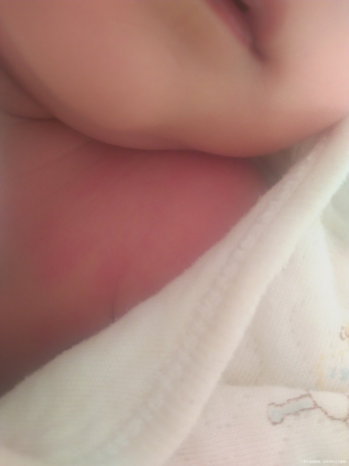 帮我看看宝宝脸颊 和肩膀都红红的是怎么了