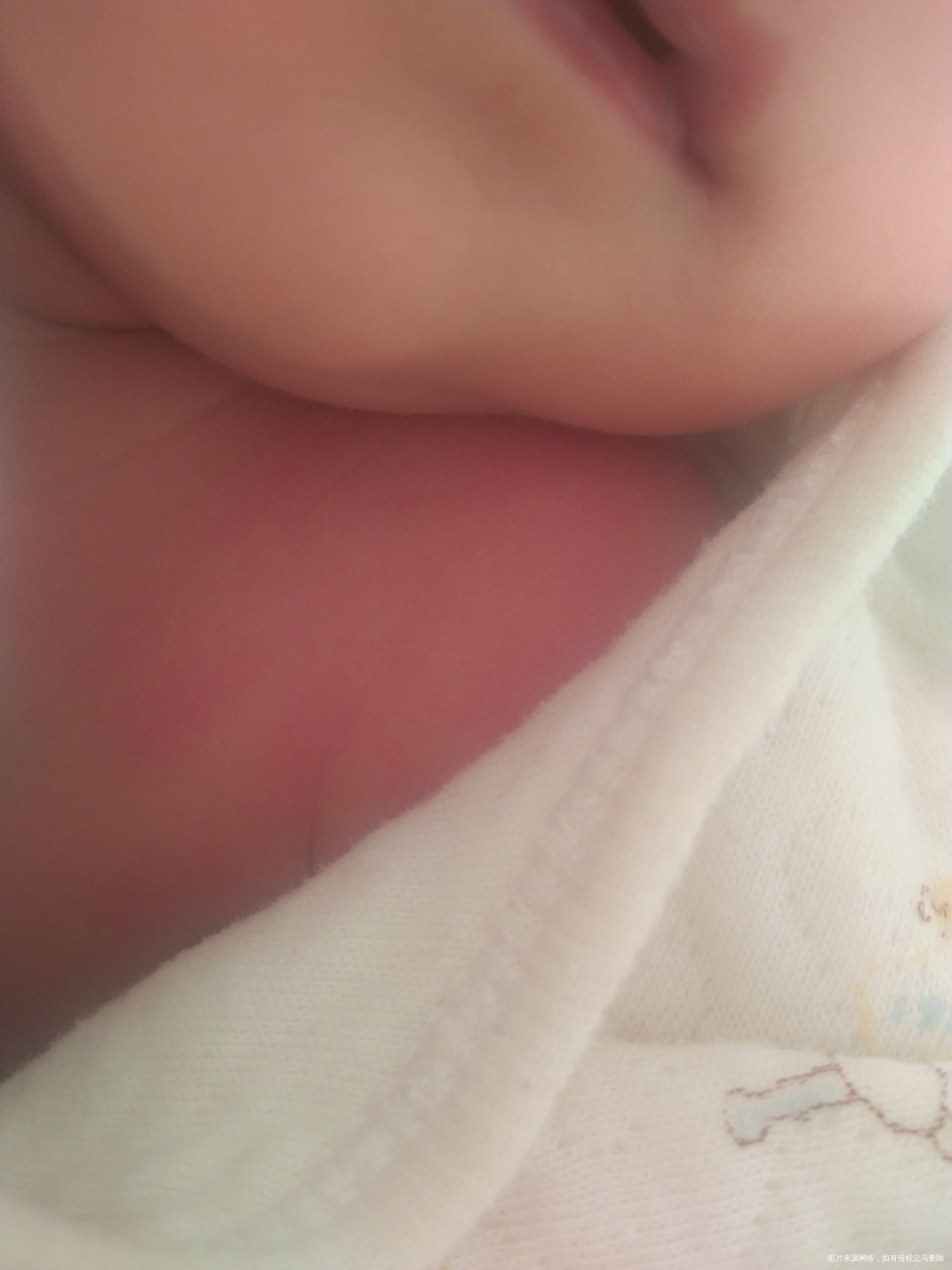 帮我看看宝宝脸颊 和肩膀都红红的是怎么了