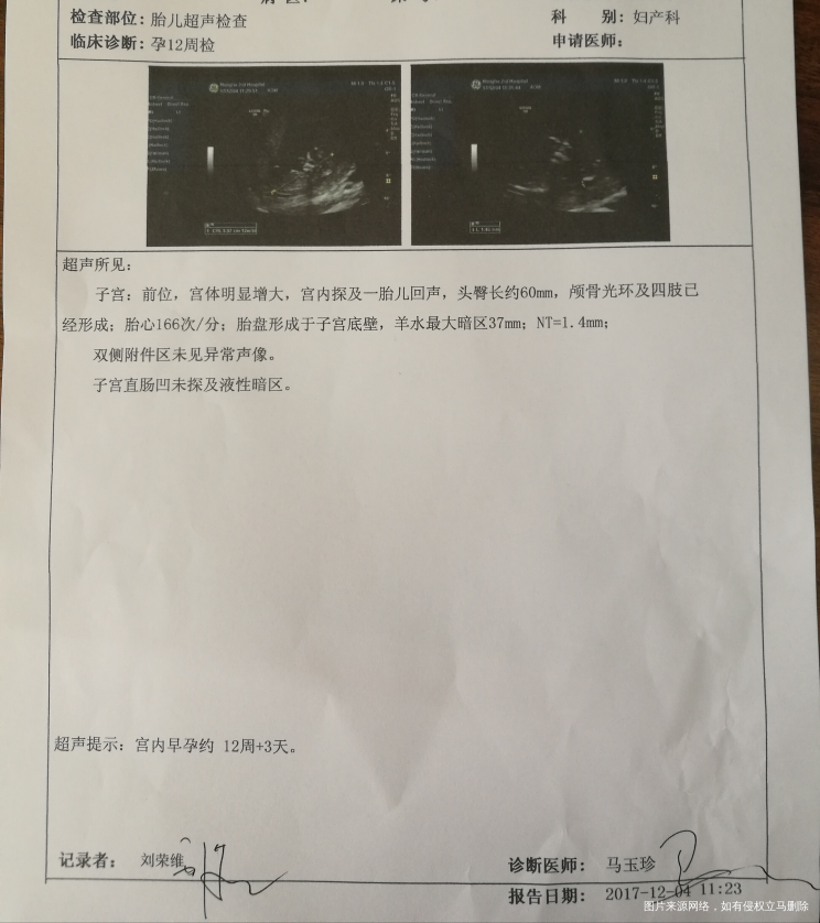 今天查了NT,通过了,很开心,医生说一切都挺好的,宝宝有6cm长了,只有我的小拇...