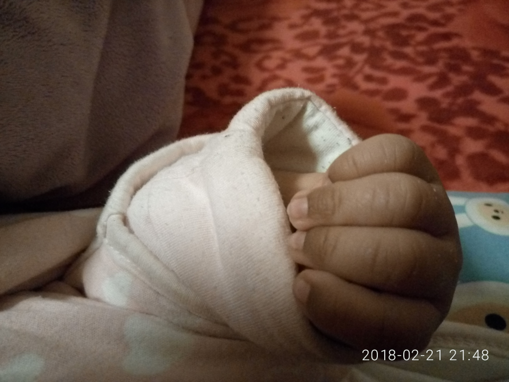 四十多天的宝宝手指甲下面发黑是怎么回事?出生和时候
