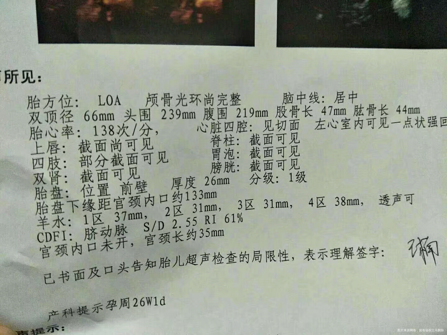 宫颈环扎术后宫口闭合一直到多少周才算安全了?