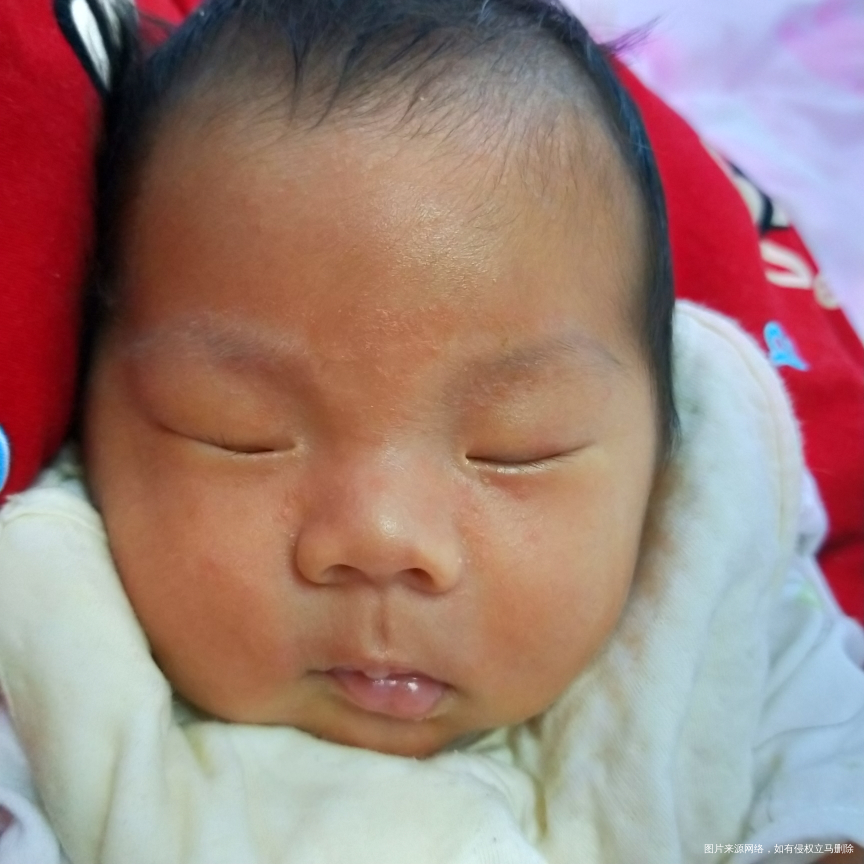 医生帮我看看宝宝脸上还有黄疸吗?