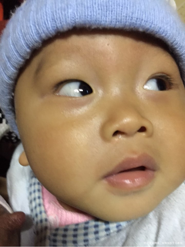 儿子喉咙发炎,一直哭闹