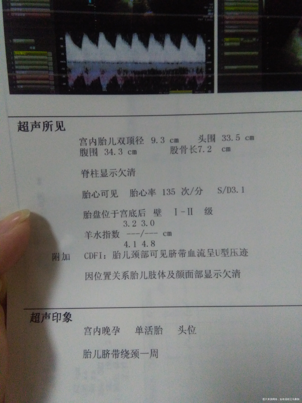 麻烦给看看孩子现在有多重