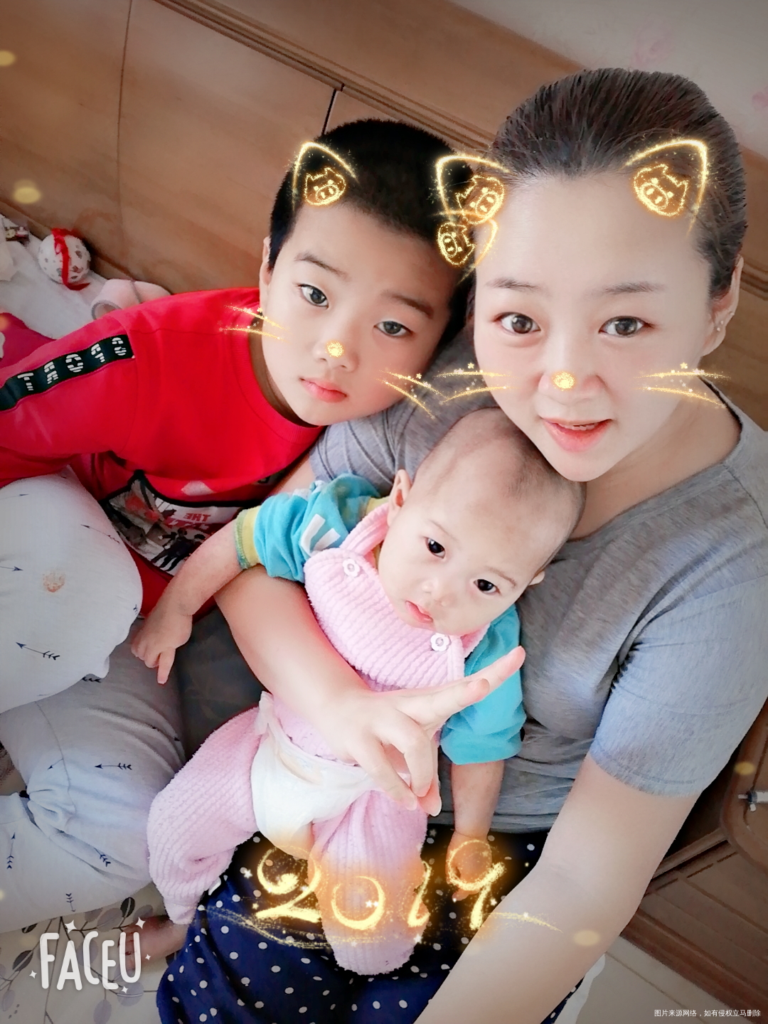 #色素失禁症宝贝#家人永远爱你