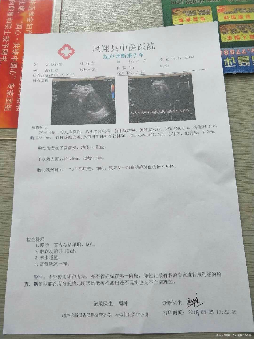 帮忙看看能顺产不,医生说孩子头大,顺产不了