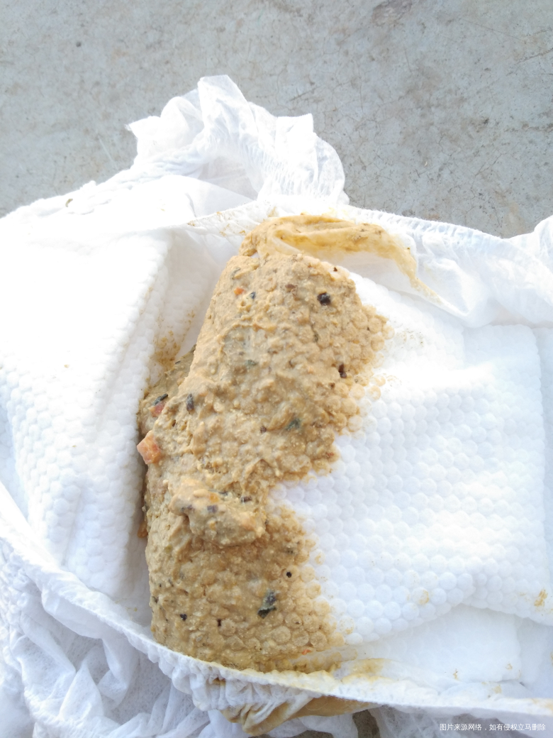 医生,宝宝拉的便便颜色正常吗,