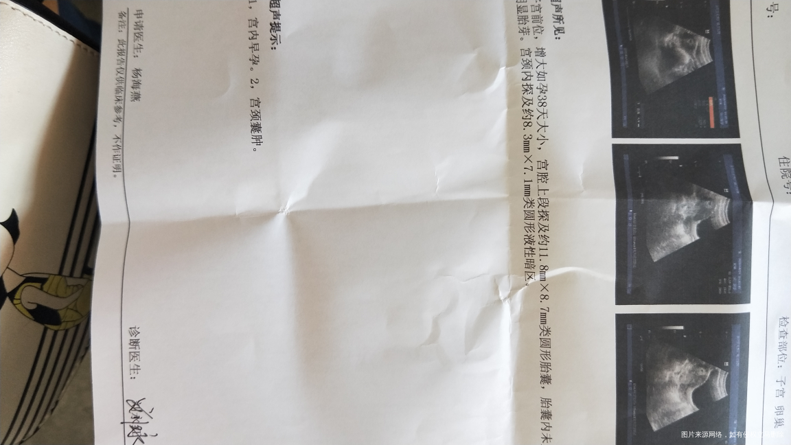 大家来看看,孕囊样子像男孩还是女孩呀?才大概38天,没有胎芽胎心呢!希望宝宝赶紧...