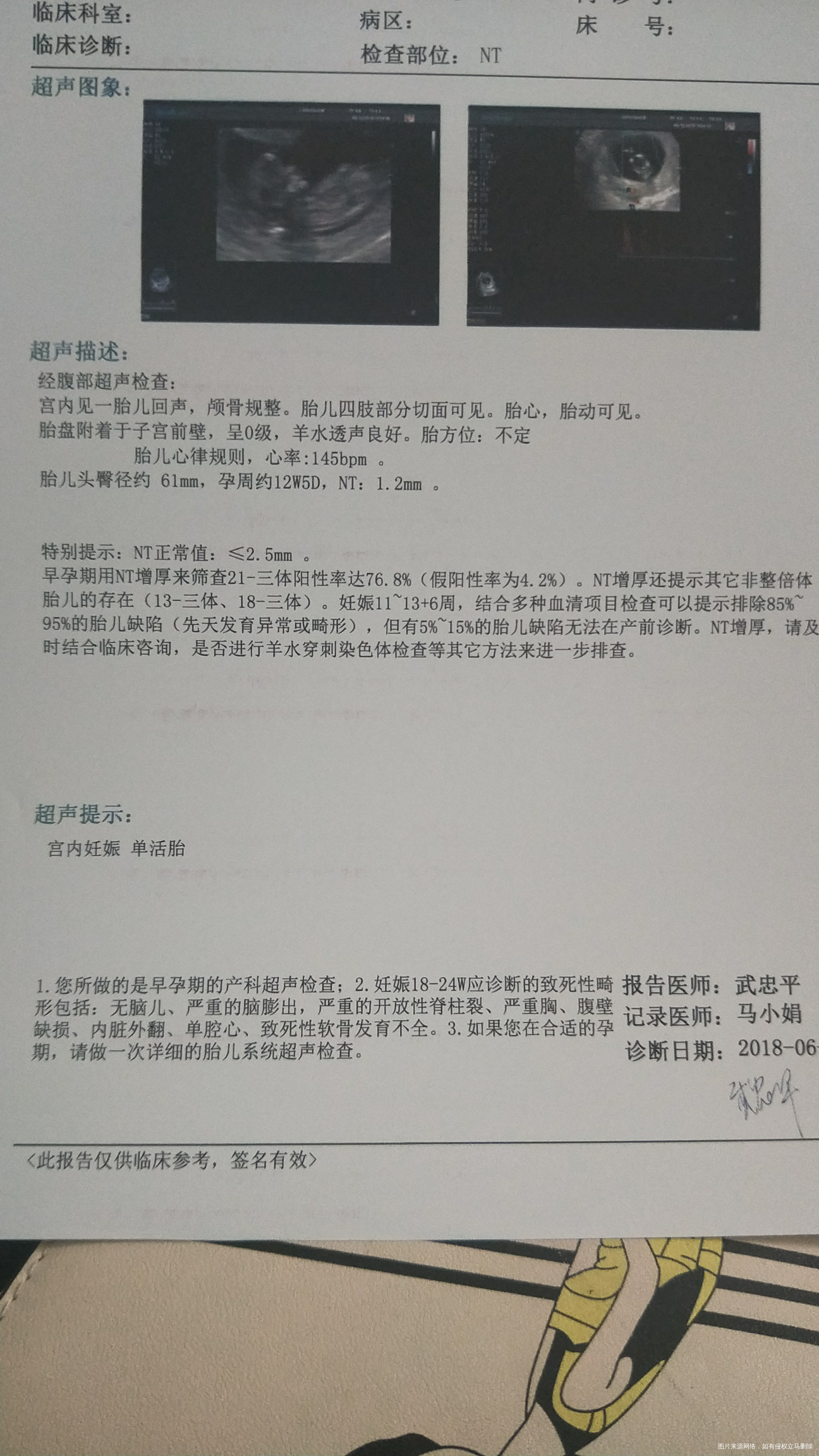 做NT归来,宝宝还算配合,第二次就过了,本以为今天可能回不了家了呢!大家看看像男...