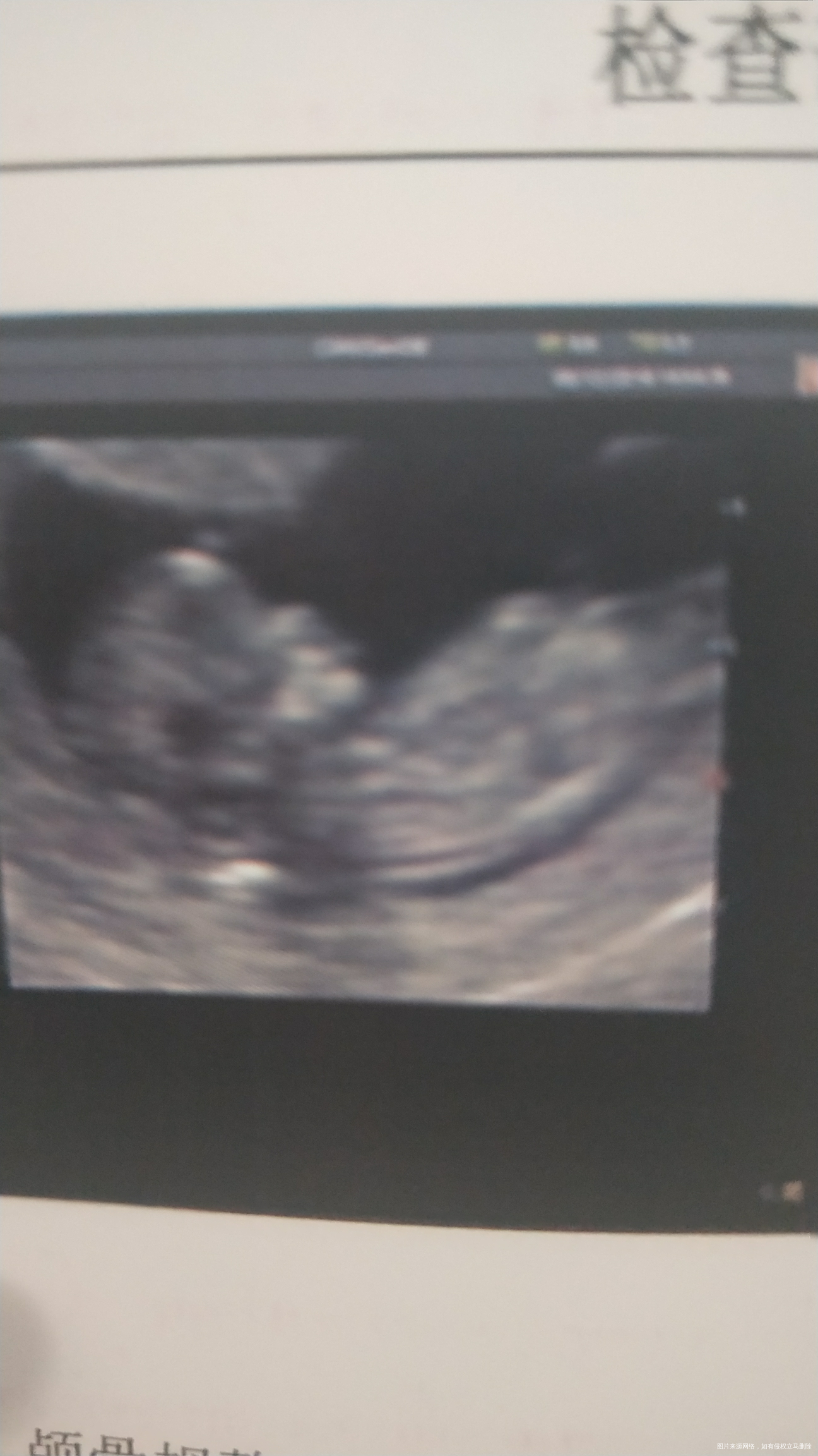 大家看侧脸图,像男生还是女生?好看还是不好看?来说说
