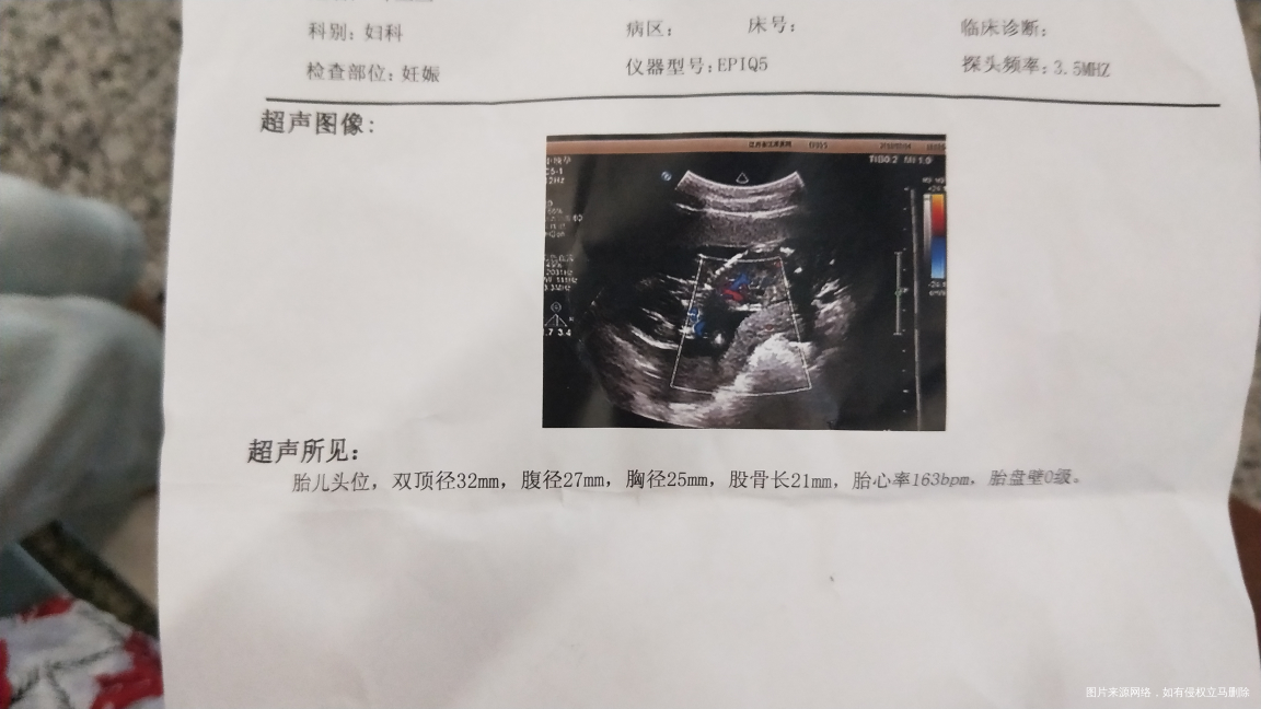 医生帮我看看现在大概16周,这个心跳是不是有点快呀?