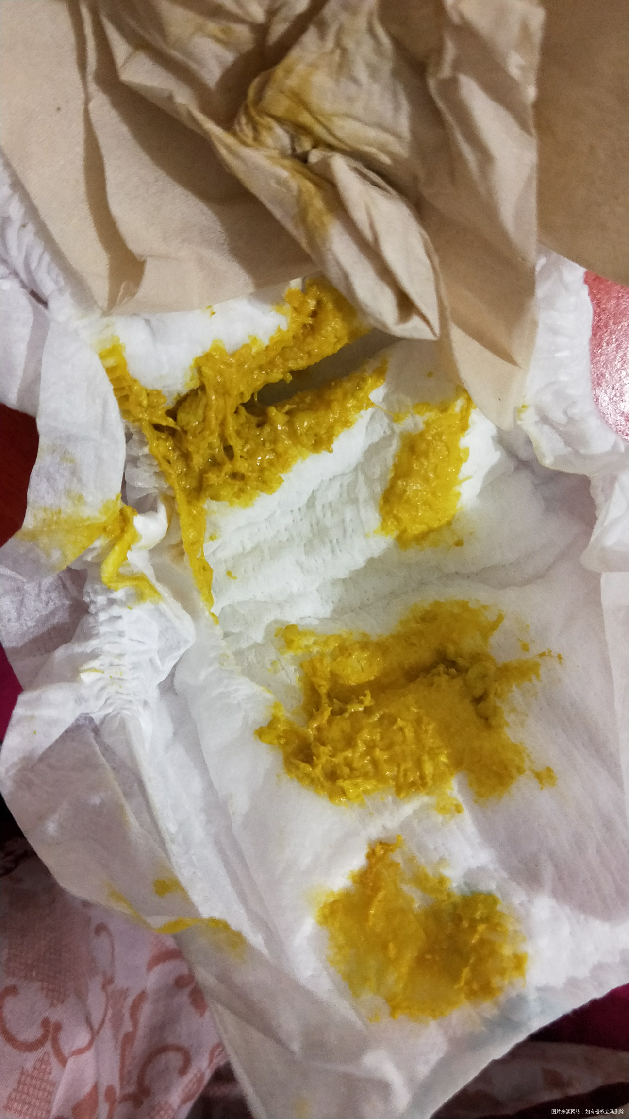 昨天一天没有排便,晚上排便三次,每次换纸尿裤里面都有便便