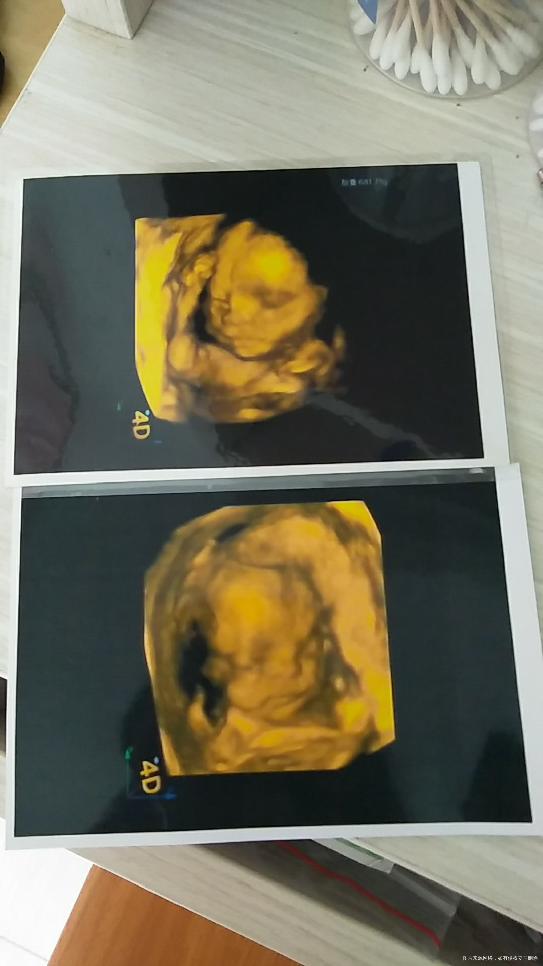 看看肚子里的像不像女儿。第一个是儿子大宝