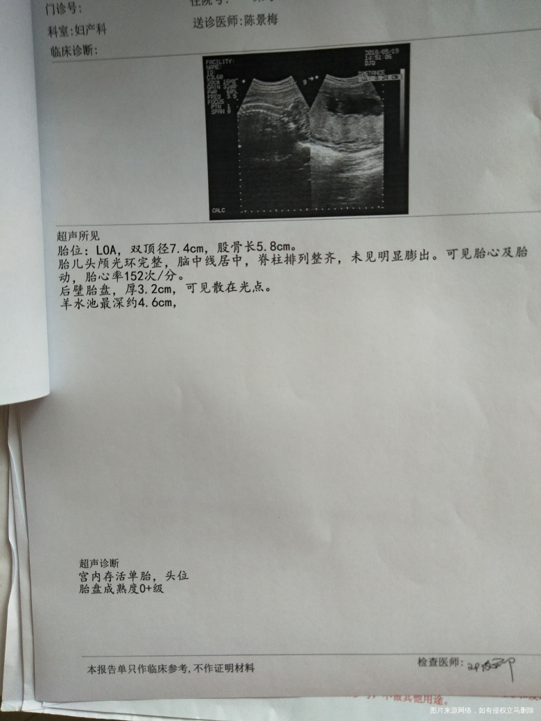 我想问问医生,宝宝现在多重了?