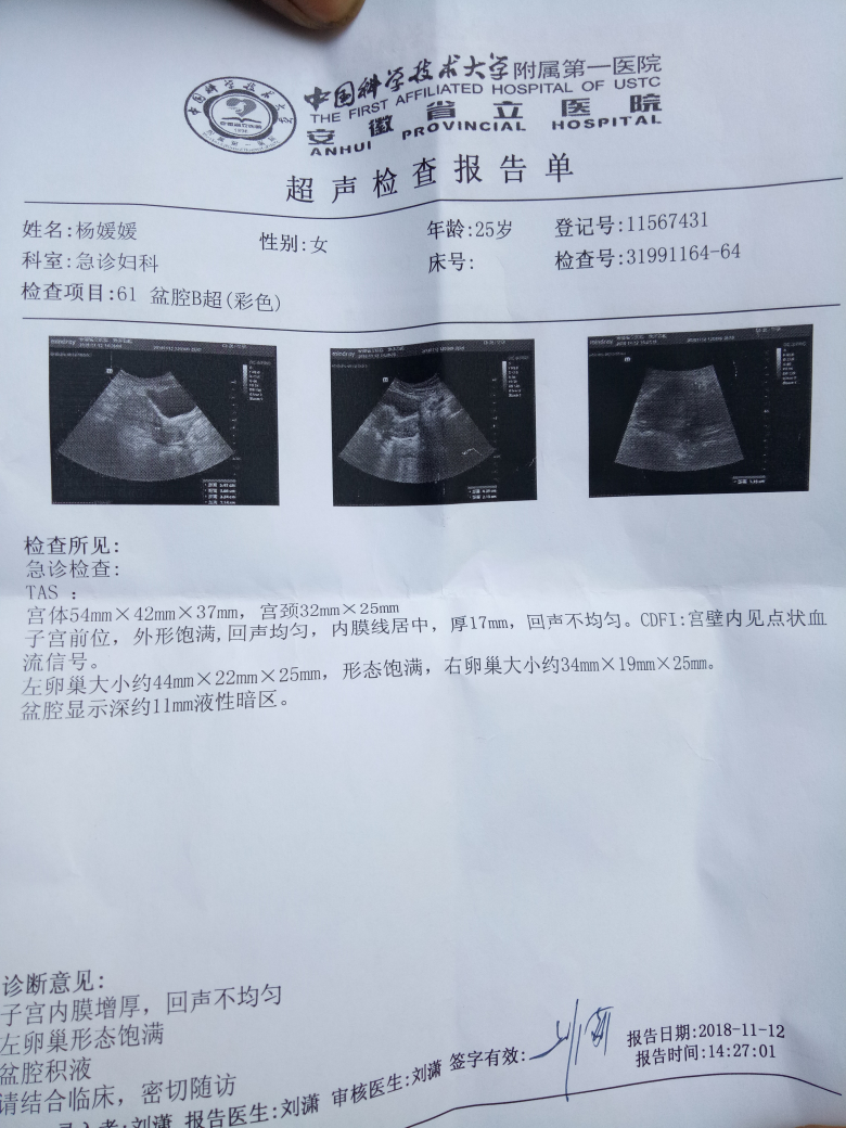 末次月经10月10号，怀孕一个月多点，有盆腔积液对胚胎发育有影响吗？