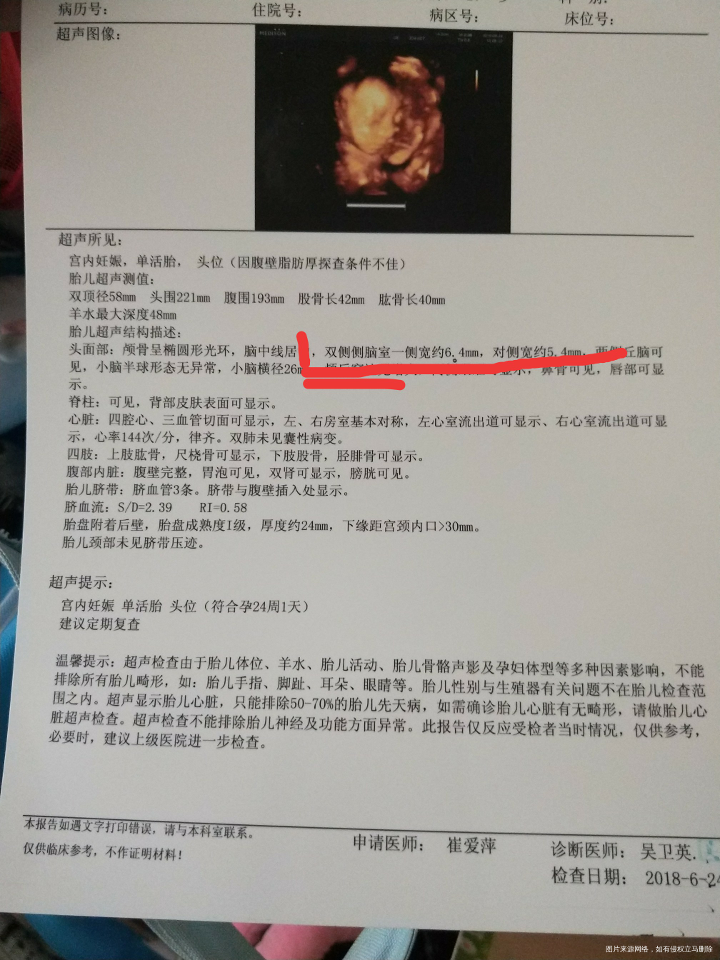 有没有医生在的?帮忙看看