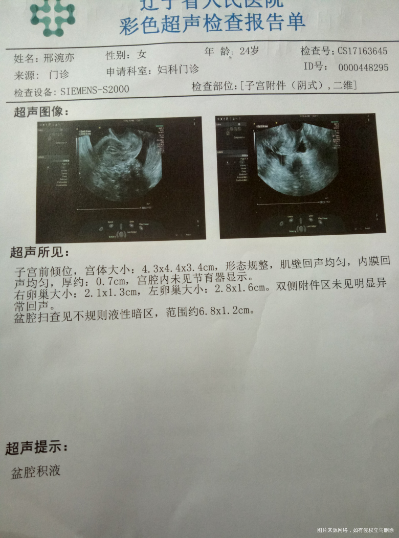 今天又做了一个超声,麻烦各位老师帮我看一看