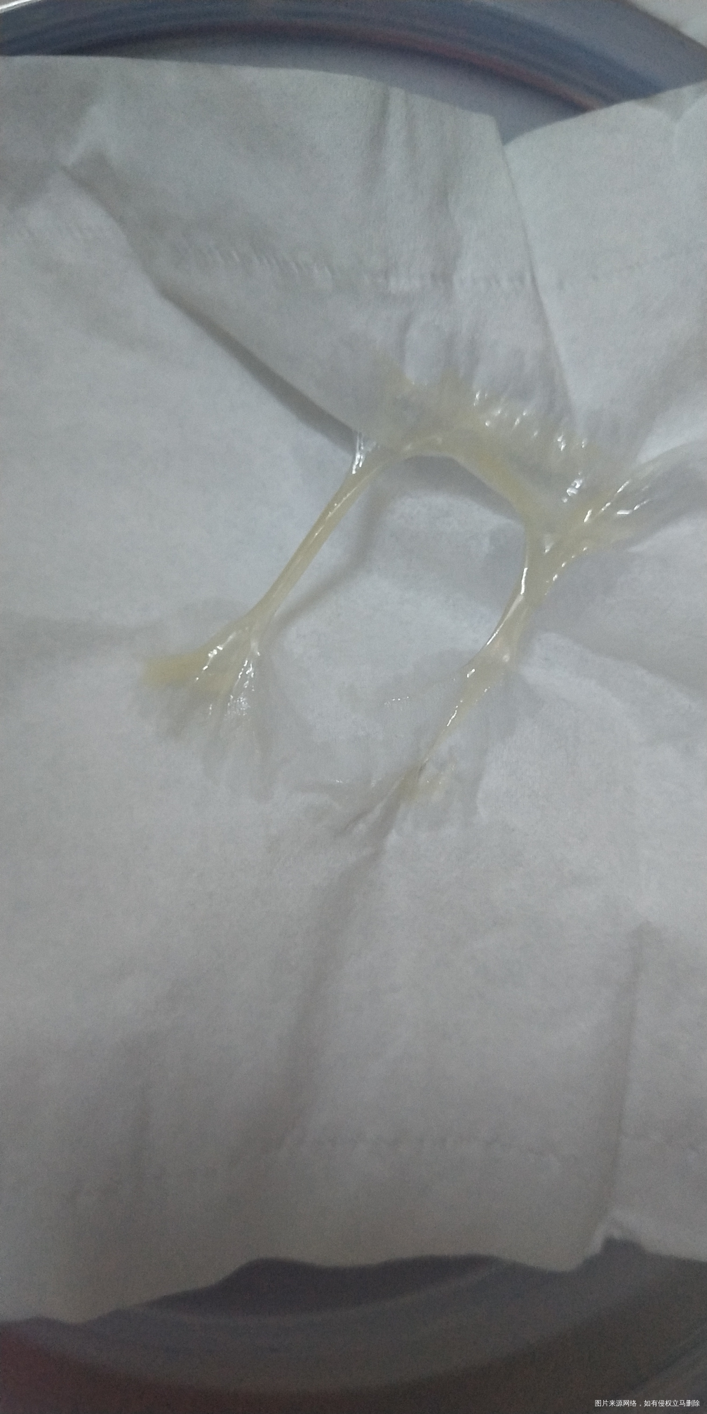 帮看一下是准备排卵了吗?