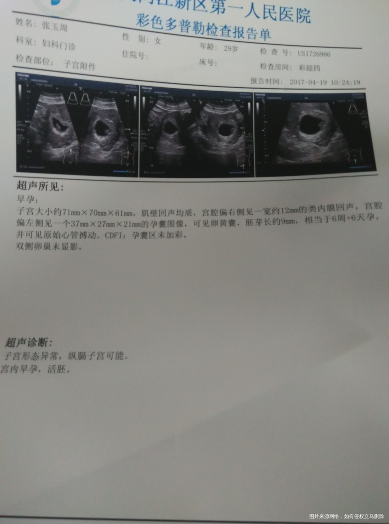 麻烦医生帮忙看看检查结果正常吗