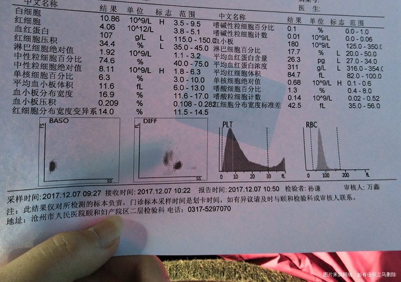 双胎38周整,这两天出现了肚子疼,肚子发硬,宝宝们可能这几天就要发动了,准备下周...