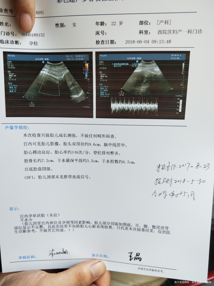 医生进来帮我看一下,谢谢!