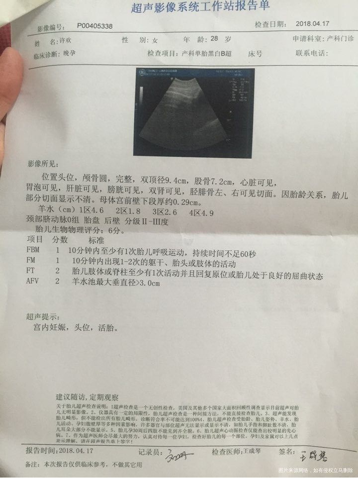 孕37周加5,今天产检单麻烦医生看看!谢谢!